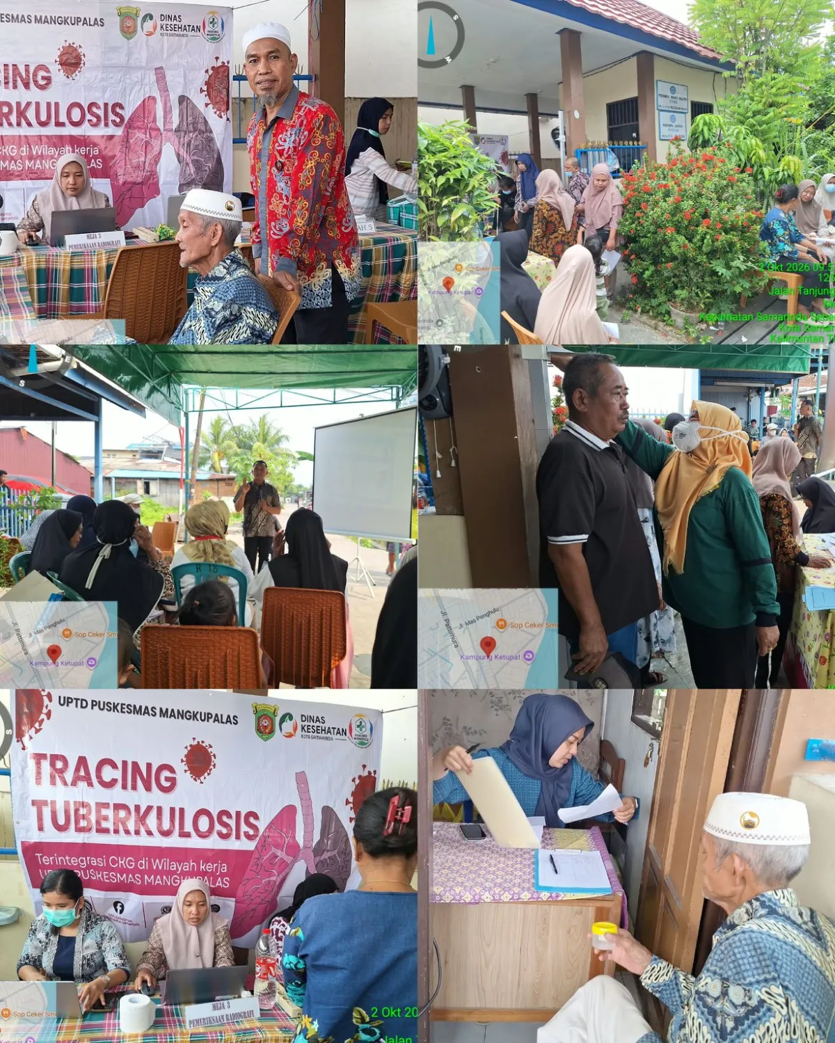 Jumat, 02 Oktober 2026 - Tracing TBC Terintegrasi CKG