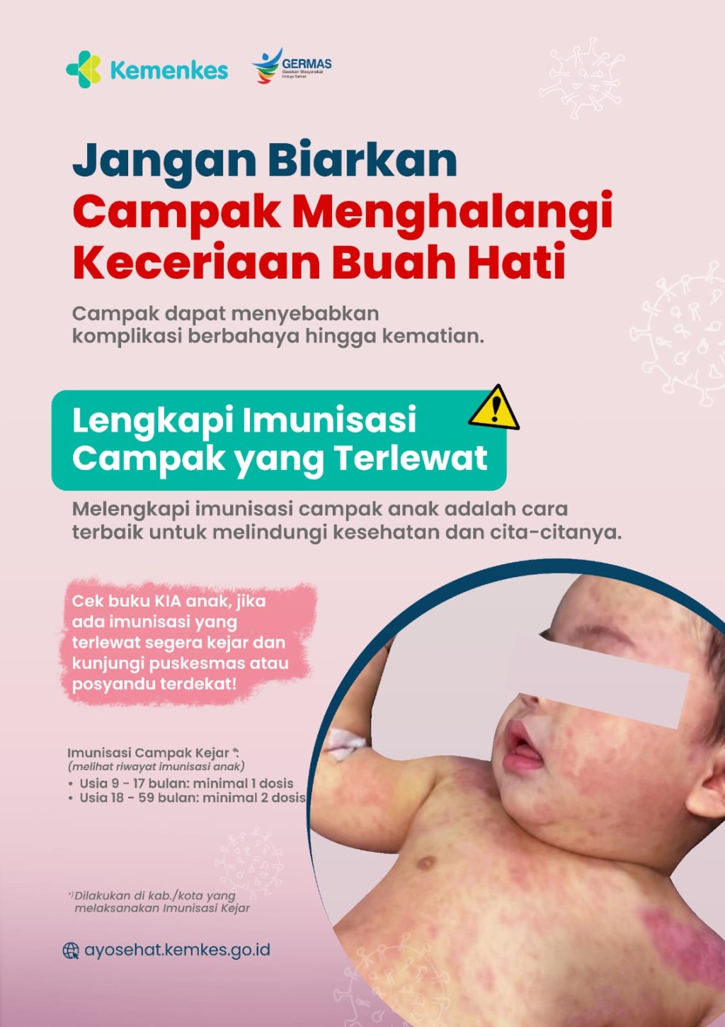 Lengkapi Imunisasi Campak Yang Terlewat